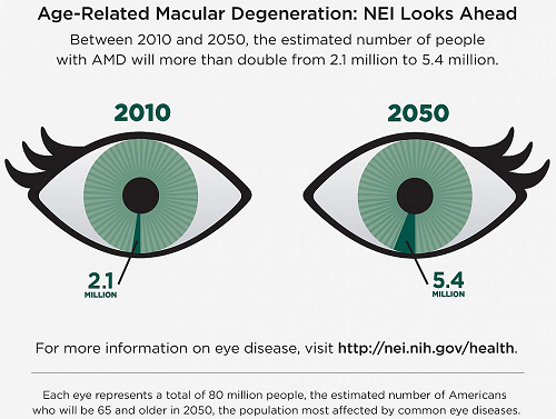 20151221-macular-degeneration.jpg