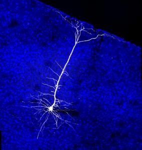 20161012-projection-neuron-mouse-visual-cortex_0_0.jpg