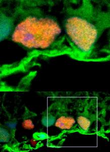 20170127-exosomes_0.jpg