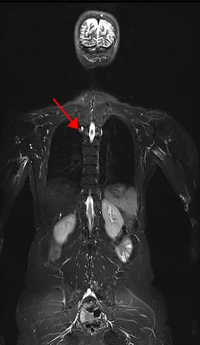 20170803-mri.jpg