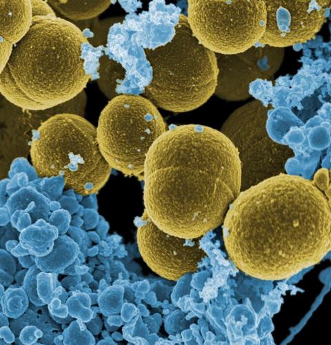 20180223-staphylococcus_0.jpg