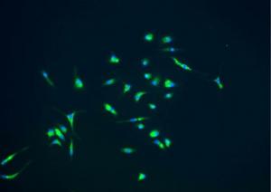 2018050517-microglia_0_0.jpg