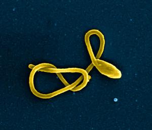 20180717-ebola-particle_0.jpg