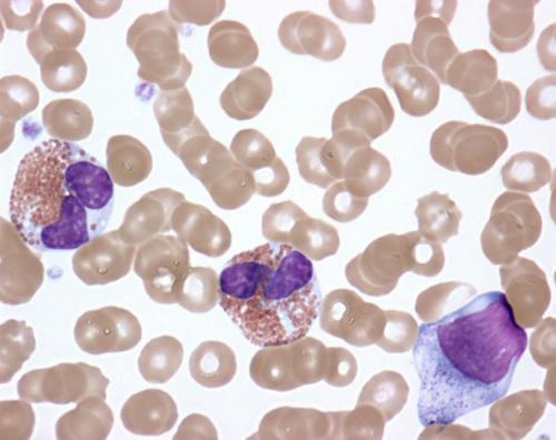 20190403-eosinophils_0.jpg