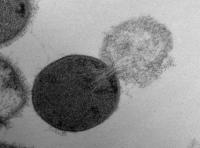 This is a transmission electron microscopy image of a Streptococcus pyogenes cell experiencing lysis after exposure to the highly active enzyme PlyC.