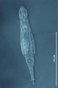 Adineta_vaga_rotifer_pillars_0.jpg