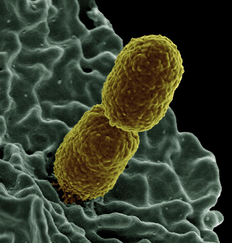 klebsiella-pneumoniae-bacteria2.jpg