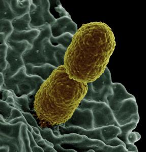 klebsiella-pneumoniae-bacteria2_0.jpg