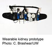 wearablekidney_sm_0.jpg