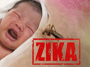 zika29.jpg