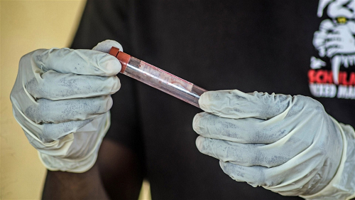 08-27-2014Ebola_Test.jpg