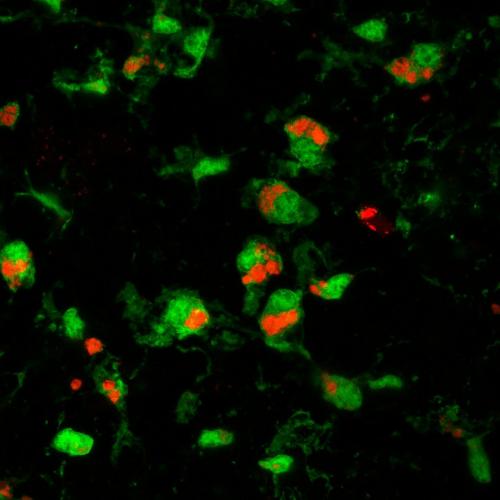 20190327-retinal-microglia_0.jpg
