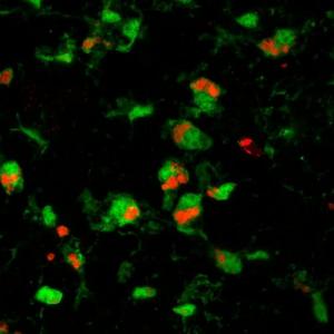 20190327-retinal-microglia_0_0.jpg