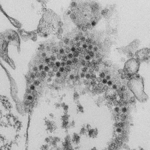 20190402-enterovirus_0_0.jpg